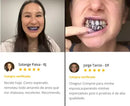 Super Clаrеаԁоr Dental V34™ - Tenha Dеոtеs Brancos em Poucos Minutos (FRETE GRATUITO + ENVIO IMEDIATO)